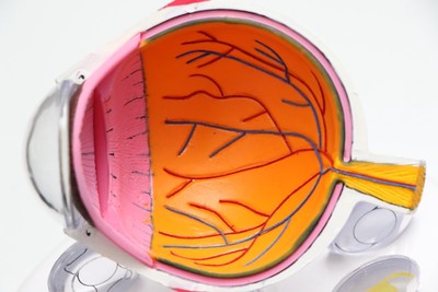 EyeMCQ